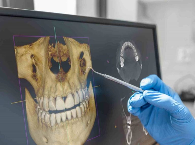 ct-snimka-zuba-rijeka