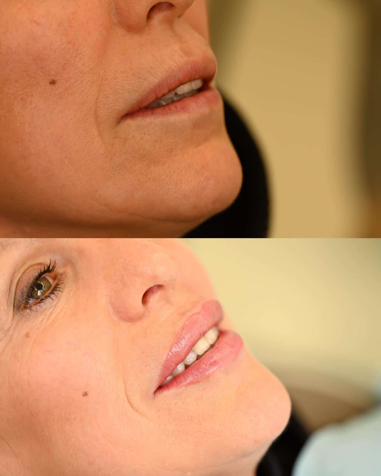 WhatsApp Image 2026-03-11 at 13.40.51